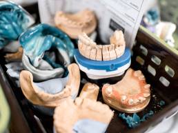 dental-models-at-the-laboratory