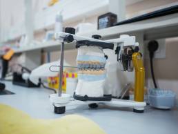 Tips In Choosing The Best Type of Dental Crown for Your Dental Needs