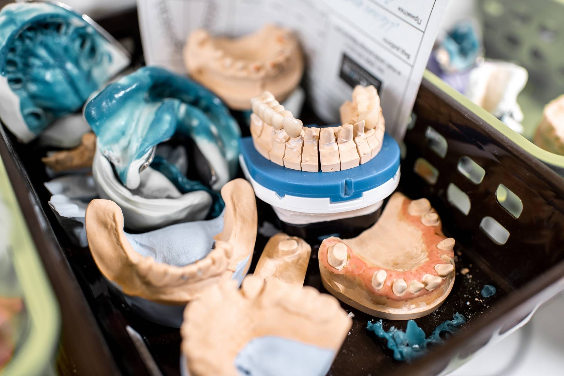 Dental Implants vs. Crowns: Which Option Is Right for You?