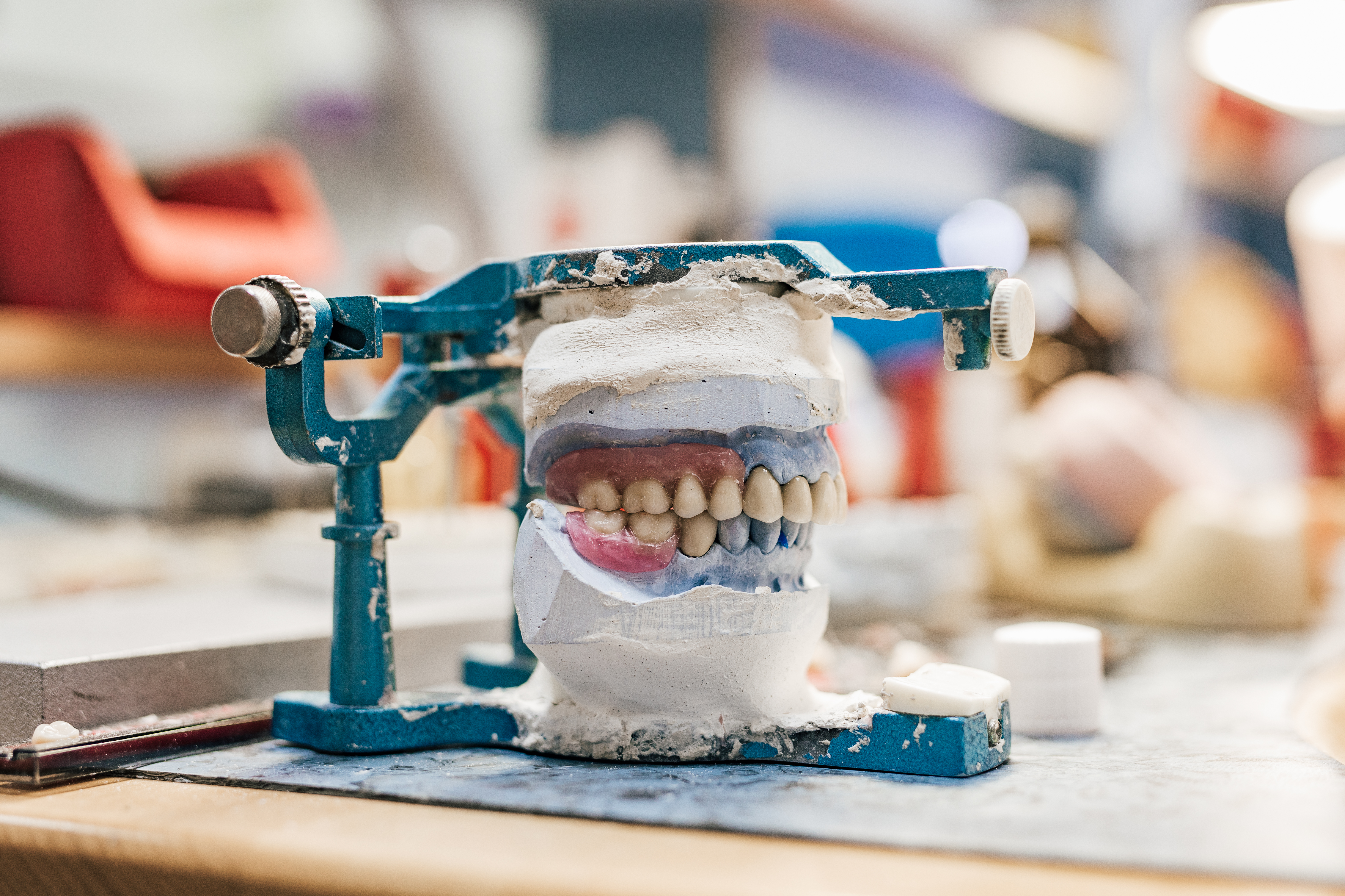 How to Choose the Right Dental Lab for Your Practice?