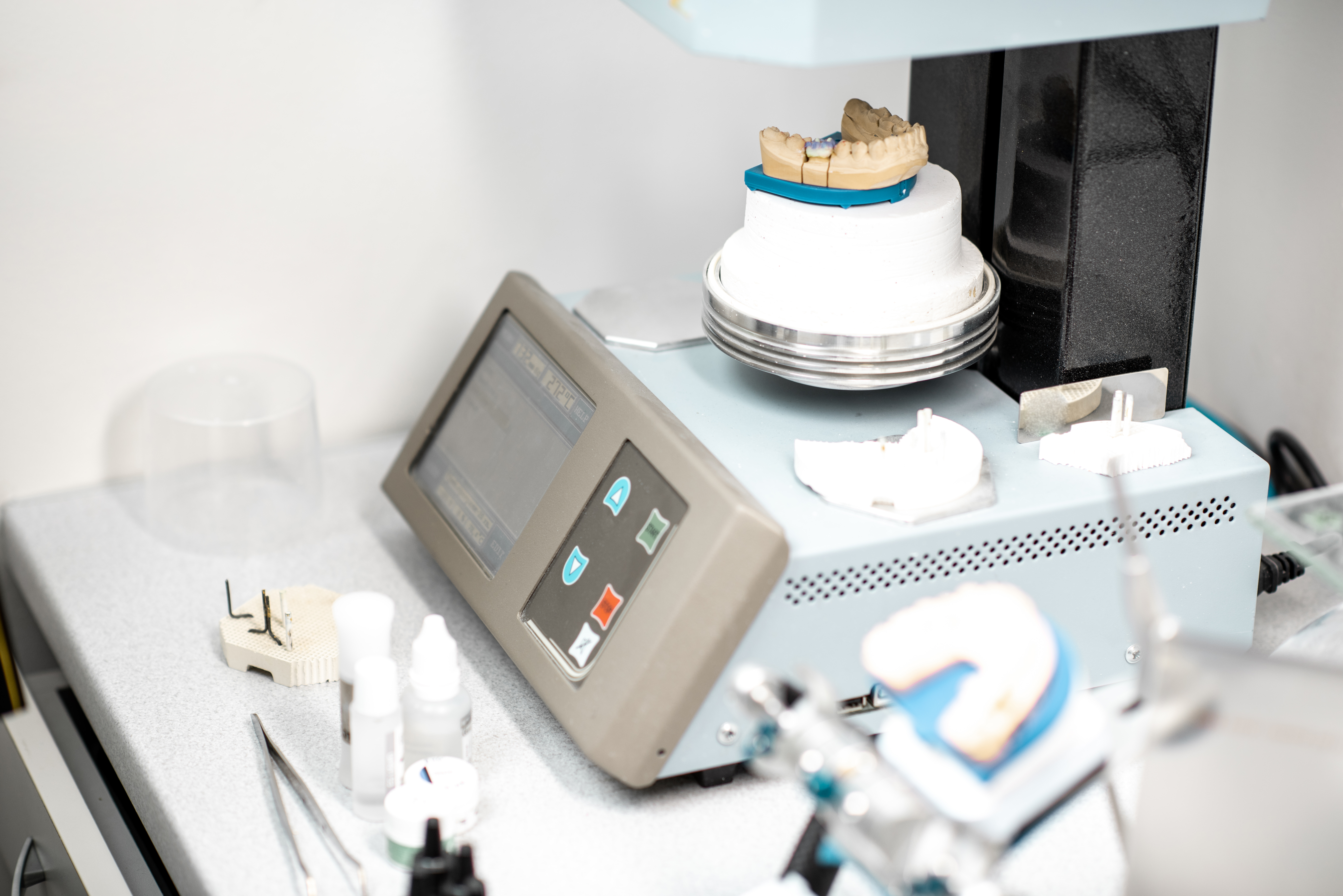 A Dental Lab’s Guide to Passive Fit and Occlusal Accuracy in All-on-X Full-Arch Restorations