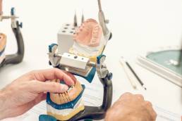 All-on-X, Overdentures, or Fixed Hybrids? Helping Dentists Choose the Right Full-Arch Solution