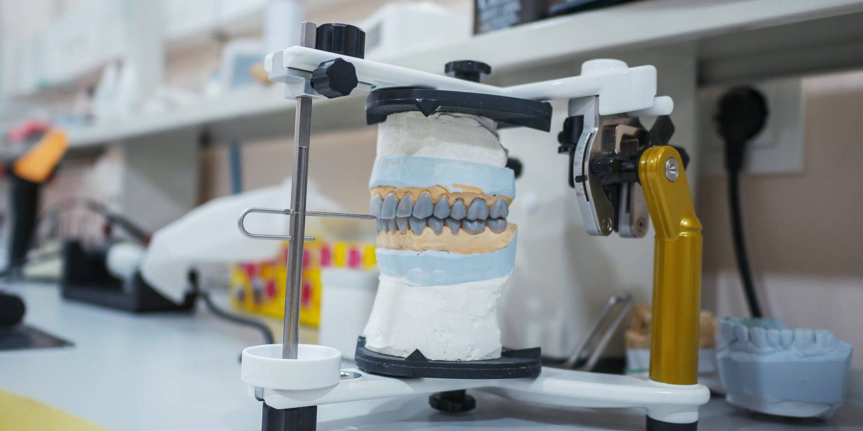 How a High-Quality Dental Lab Reduces Chair Time for Dentists