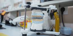 How a High-Quality Dental Lab Reduces Chair Time for Dentists