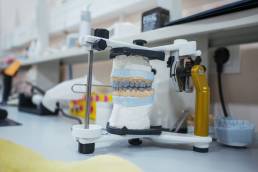 How a High-Quality Dental Lab Reduces Chair Time for Dentists